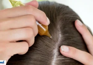 تکنیک ژاپنی ها برای رشد انفجاری موها لو رفت